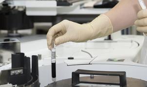 La Hemoglobina glicosilada